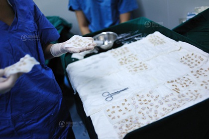 Cảm[-]động[-]hai[-]người[-]con[-]trai[-]xẻ[-]da[-]cứu[-]cha[-]già[-]bị[-]bỏng